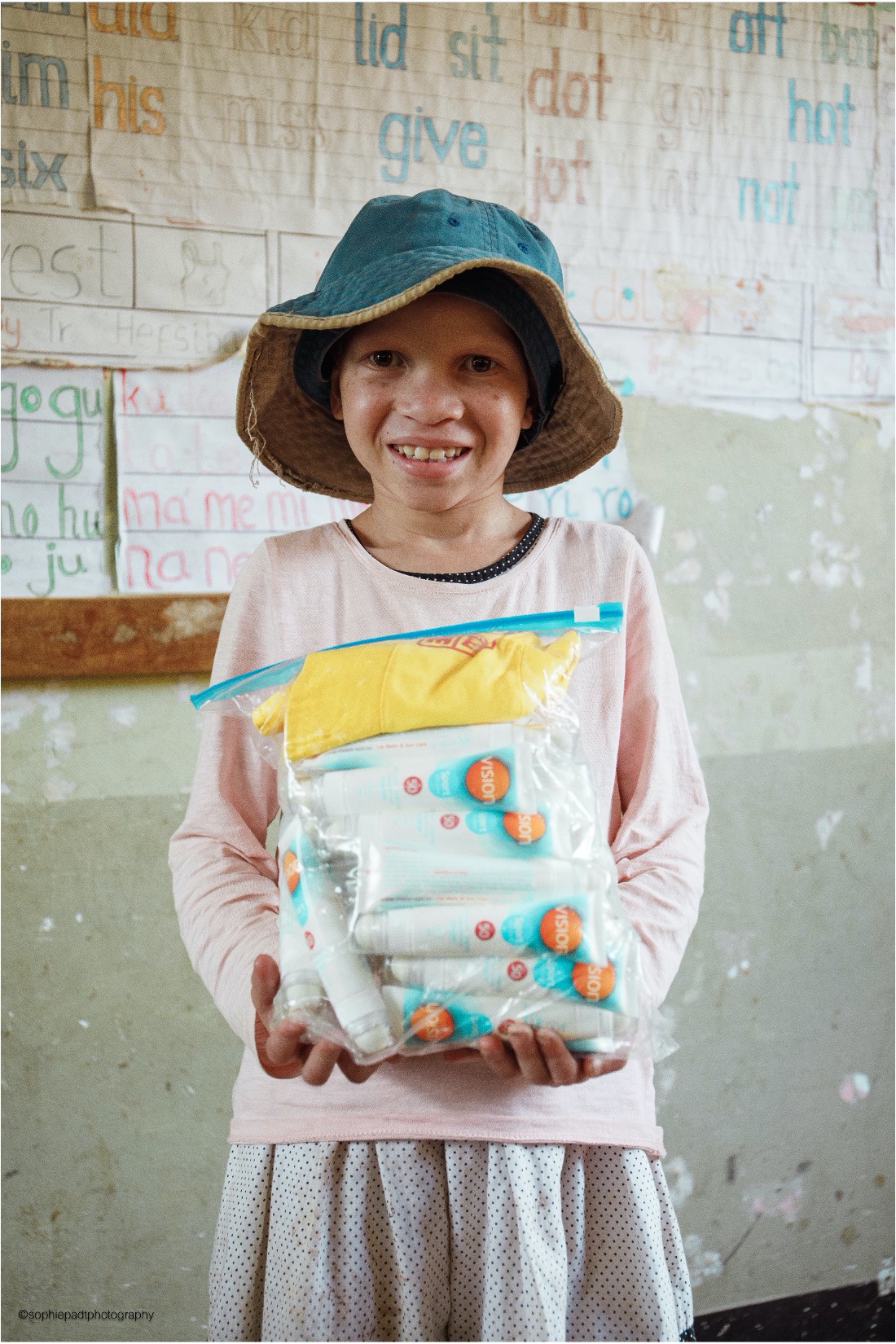 Kind met albinisme met zonnebrand, Sunscreen Campaign
