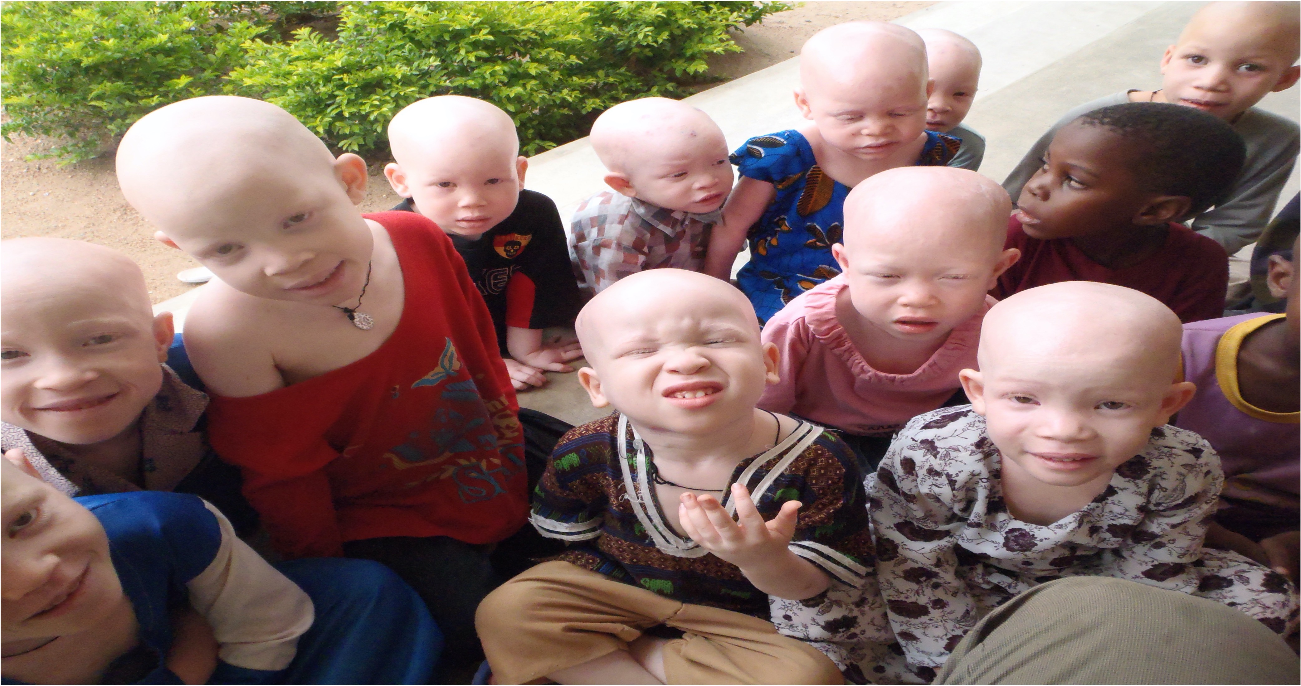 Kinderen met albinisme in Lamadi, Tanzania, ondersteund door Unity for Albinism