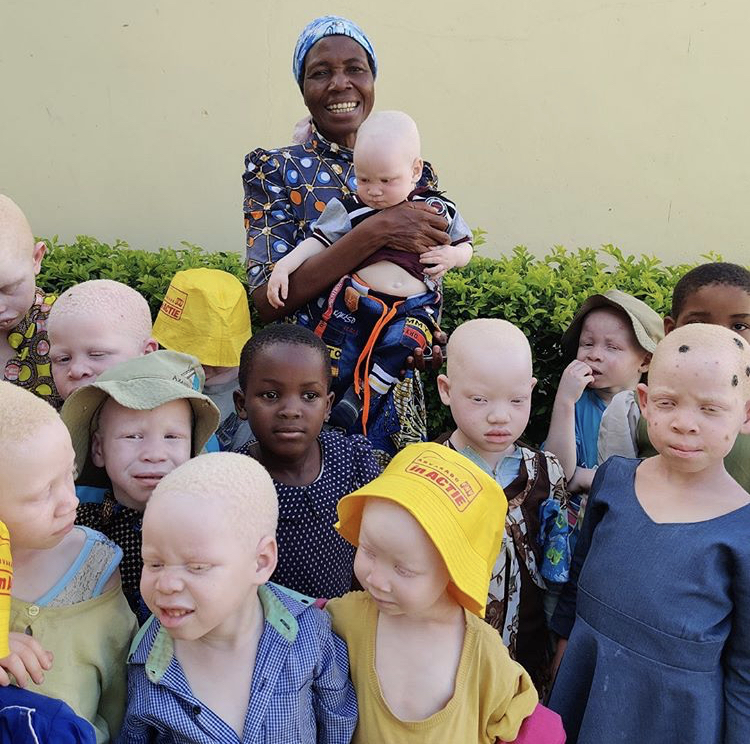 Kinderen met albinisme in Tanzania